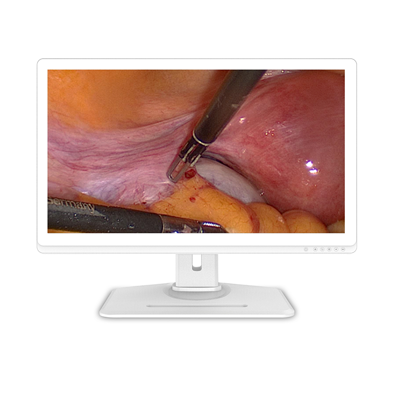 Surgical Medical Display